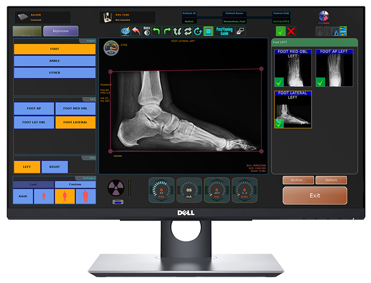 20/20 Imaging PXS-710 Podiatry X-Ray machine