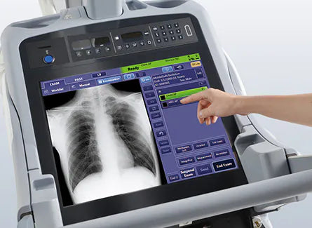 digital xray mobile wireless DR panel shimatzu