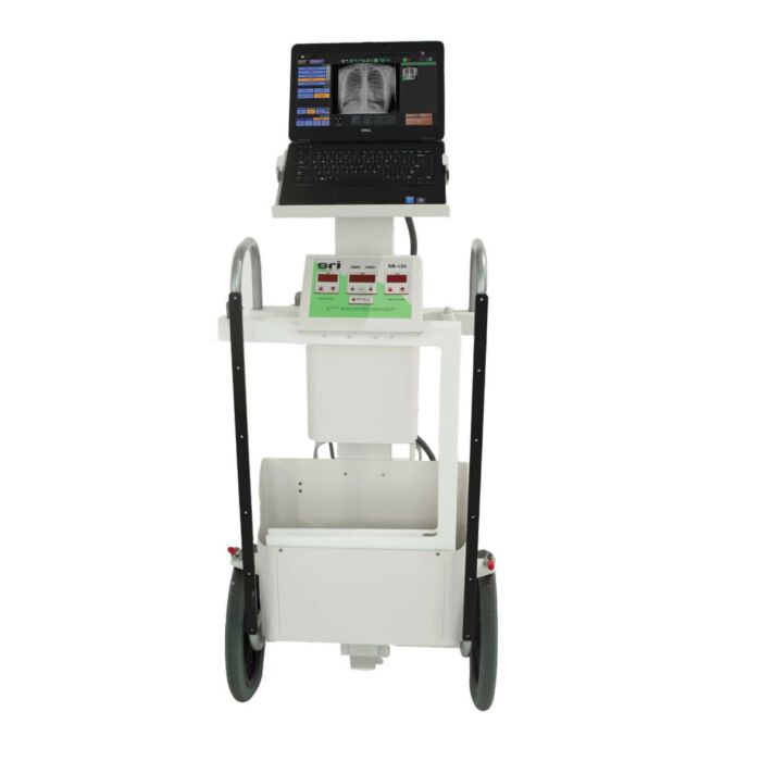 digital portable xray source ray SR-30