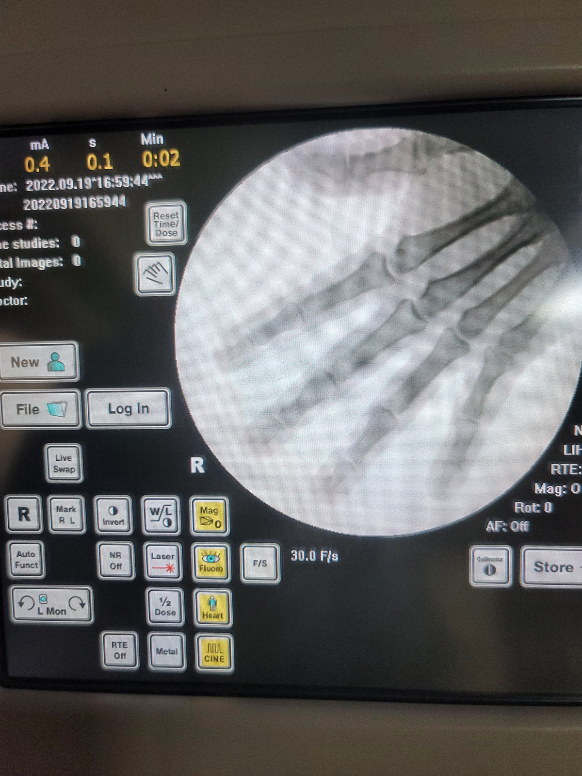 ziehm quantum mobile c-arm
