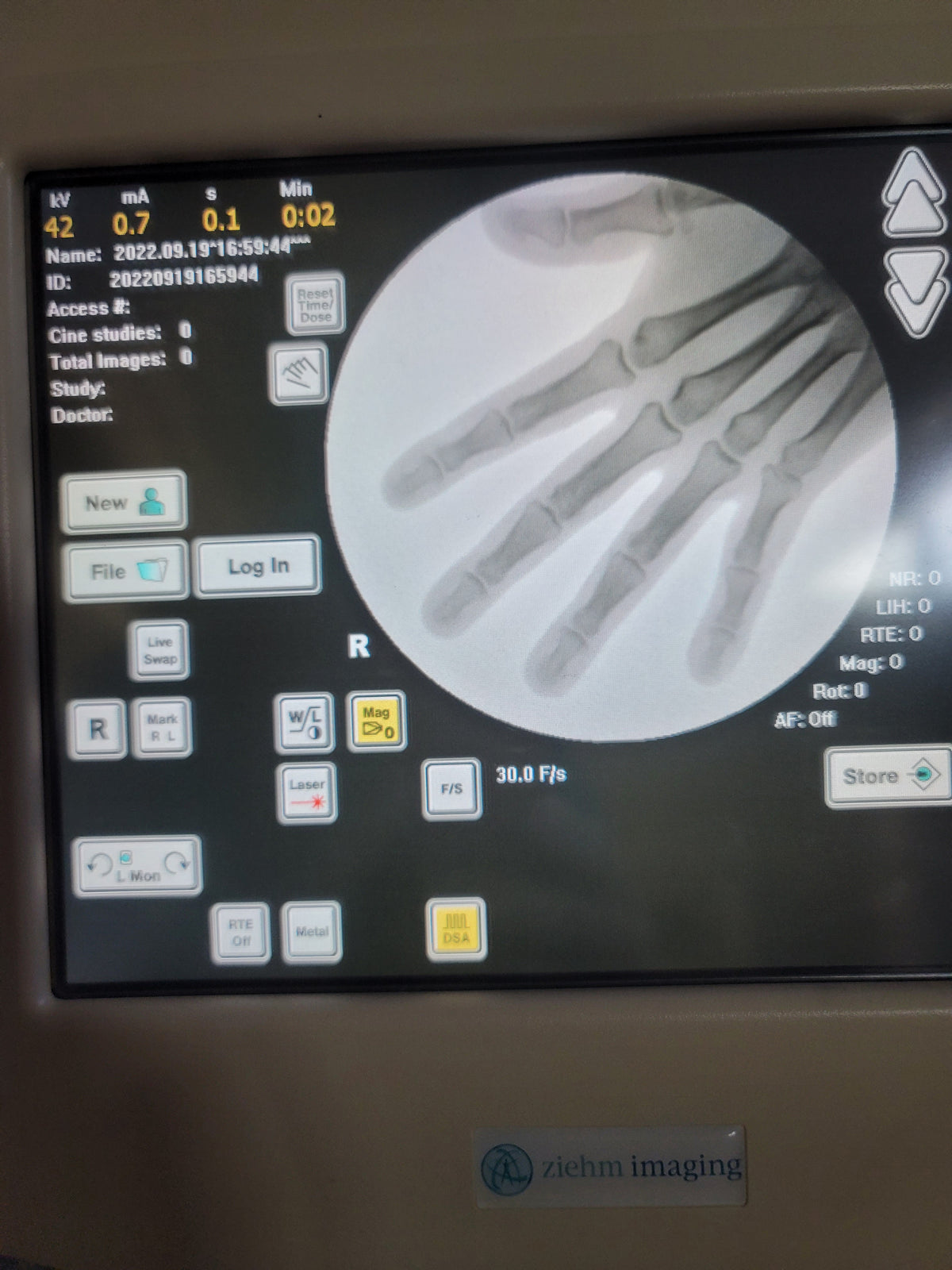 ziehm quantum mobile c-arm