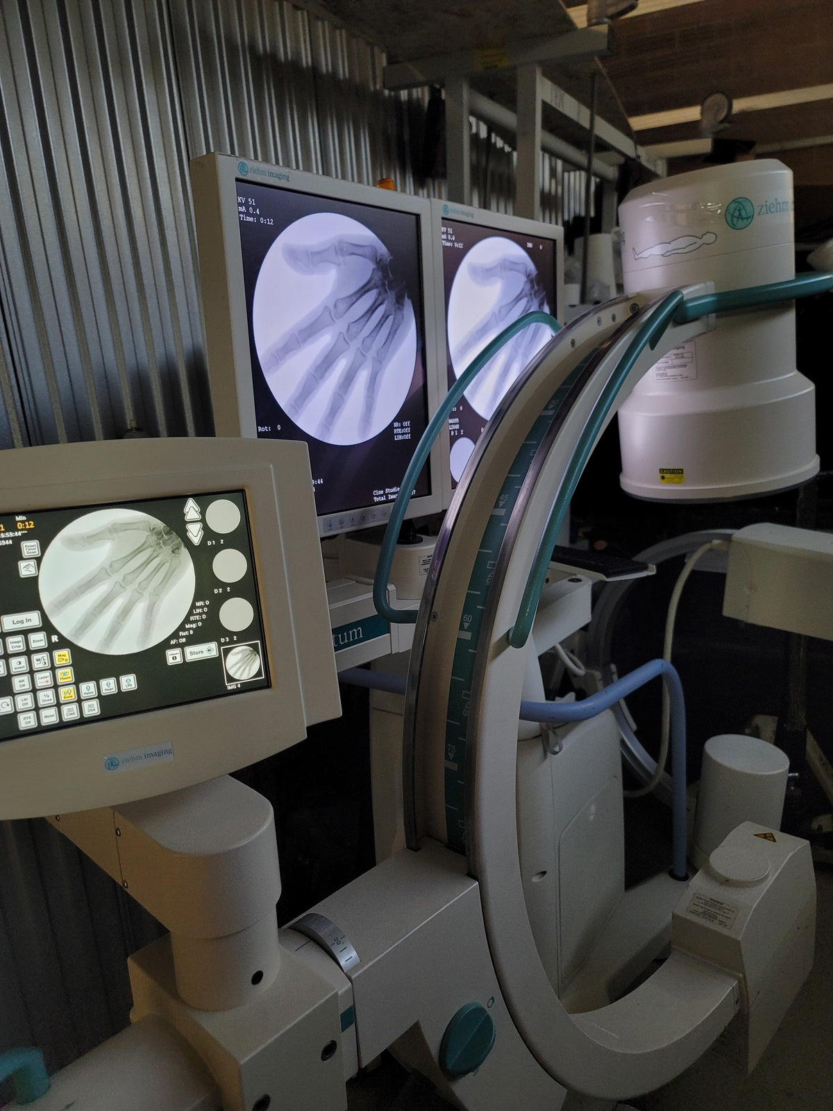 ziehm quantum mobile c-arm
