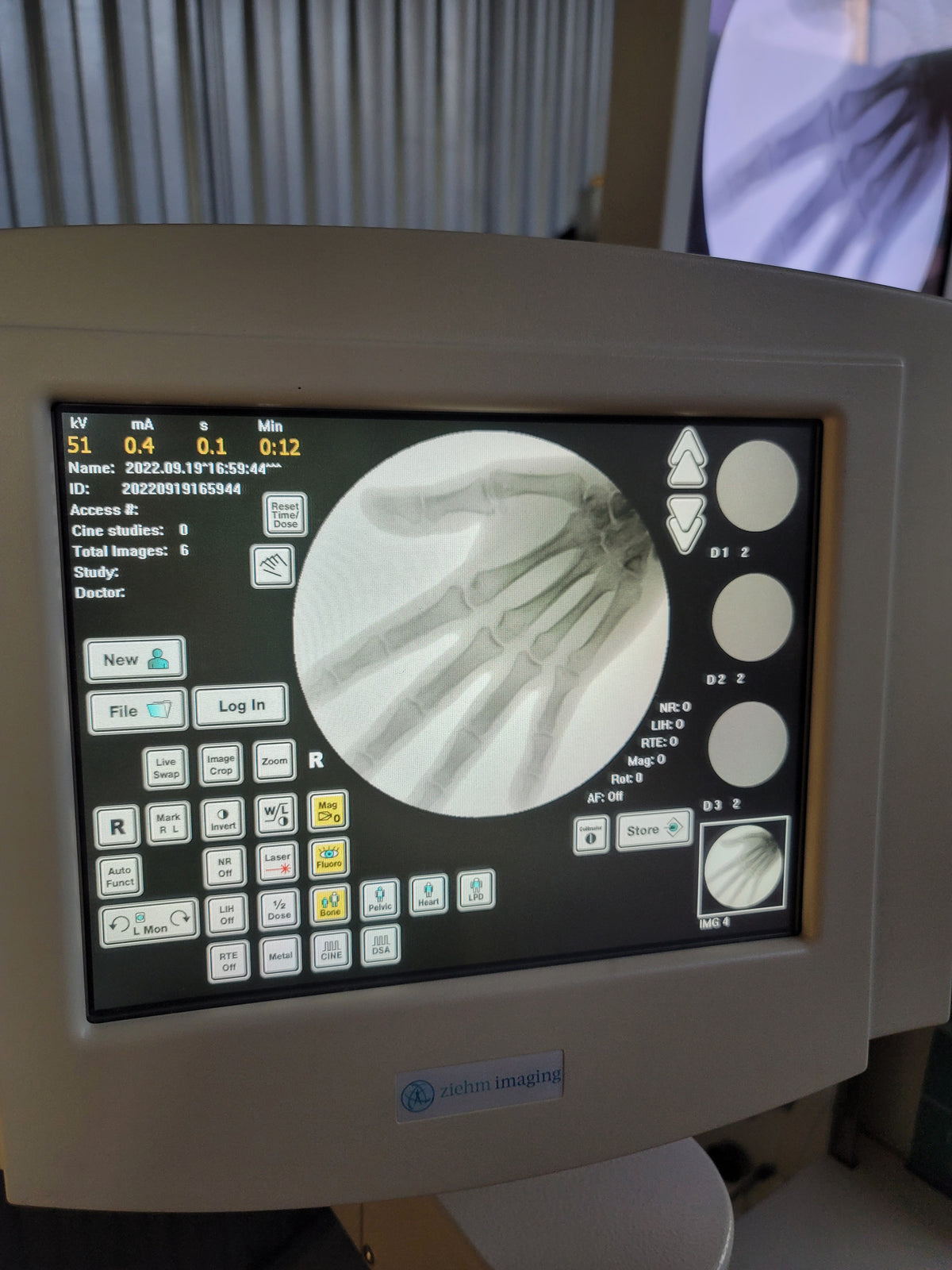 ziehm quantum mobile c-arm