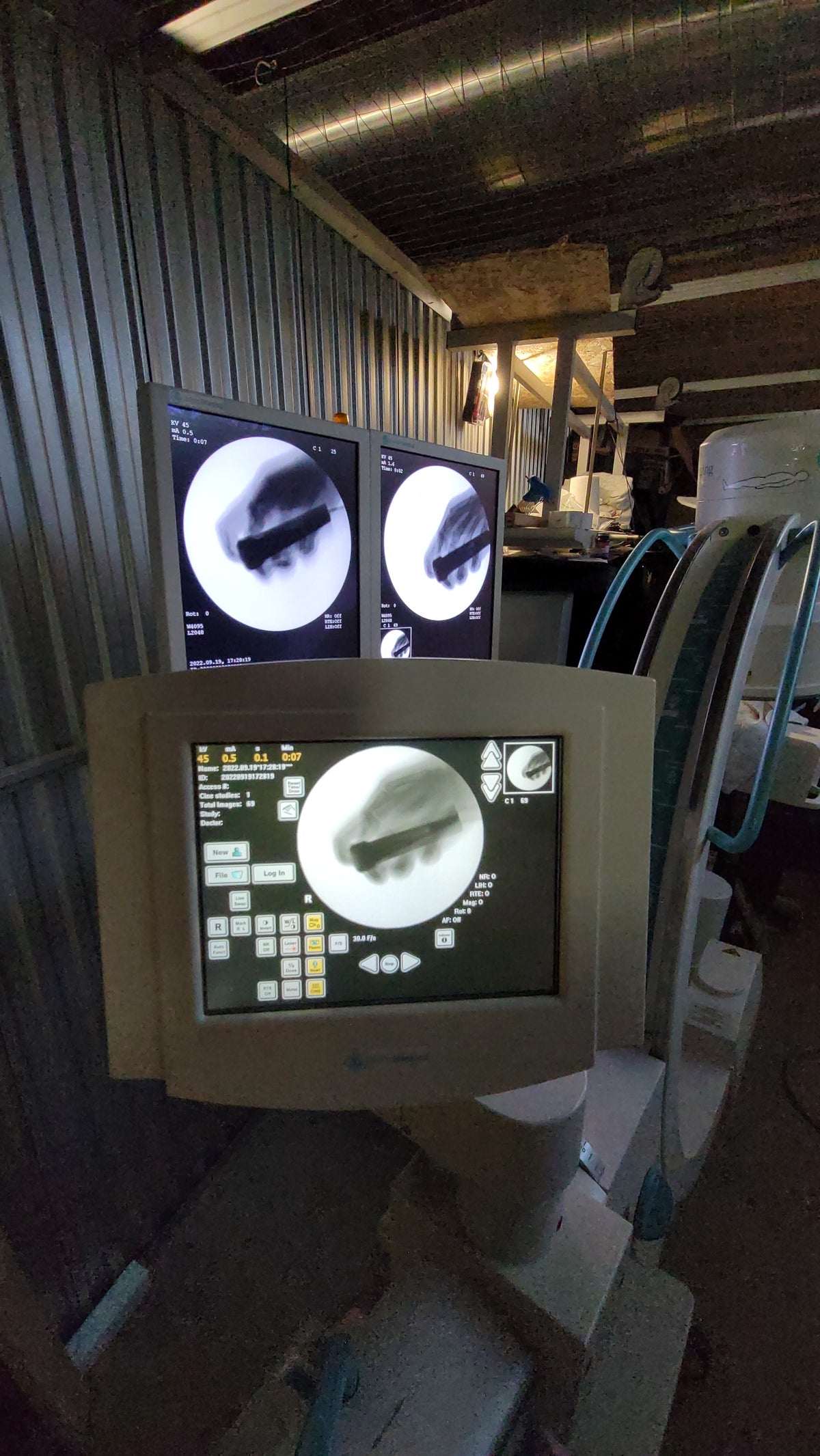 ziehm quantum mobile c-arm