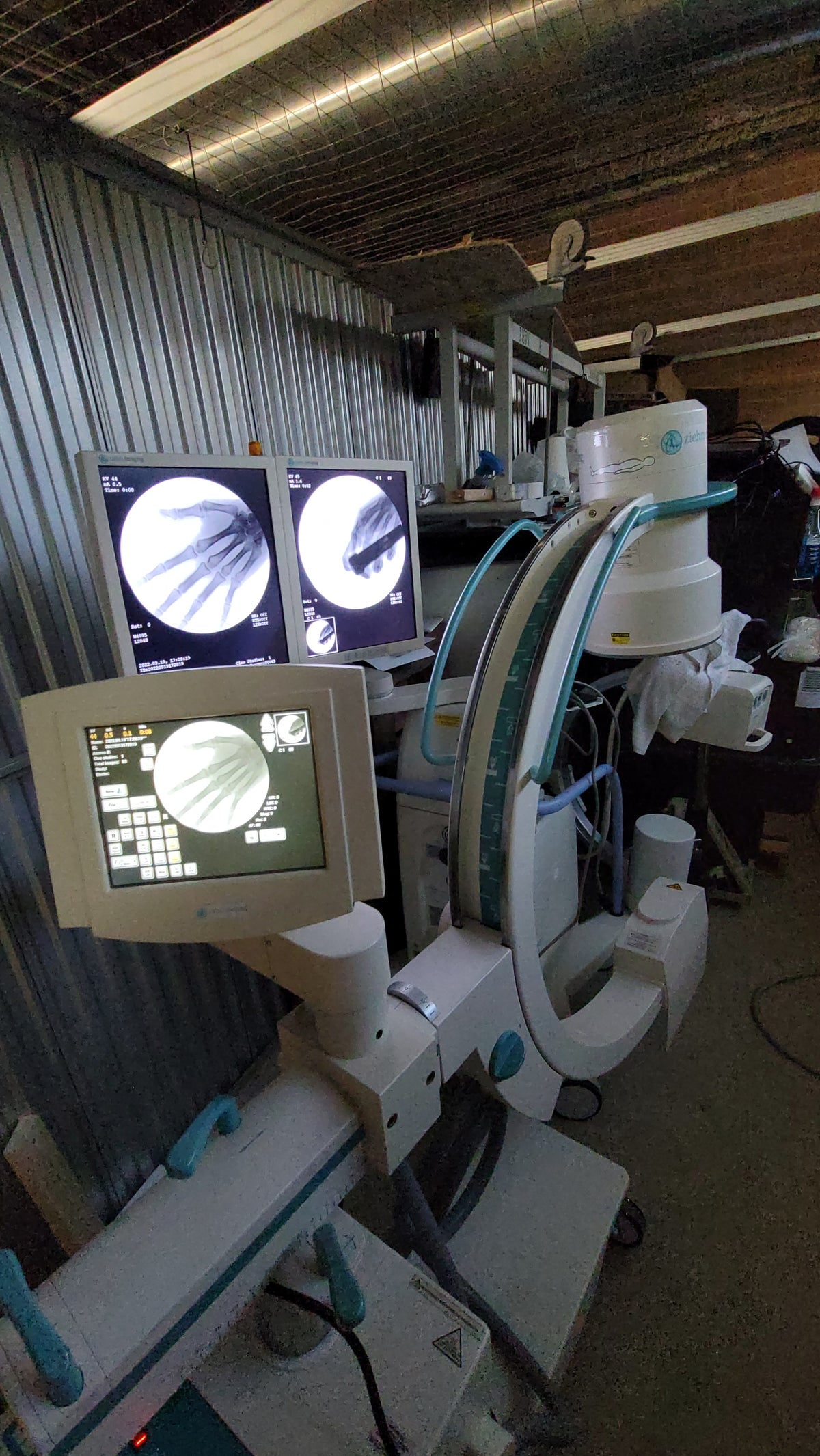 ziehm quantum mobile c-arm