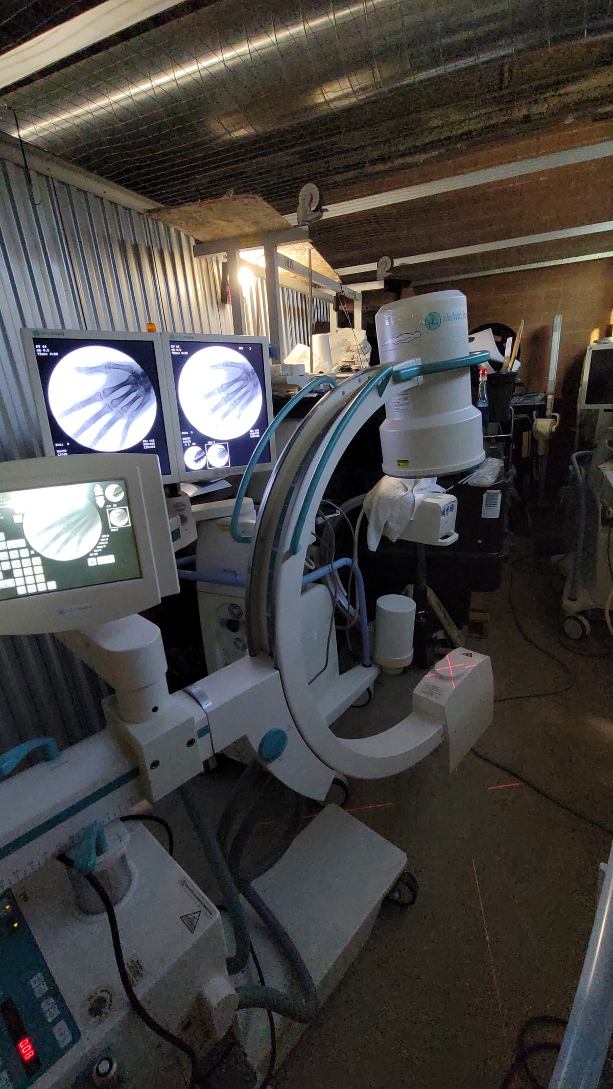 ziehm quantum mobile c-arm