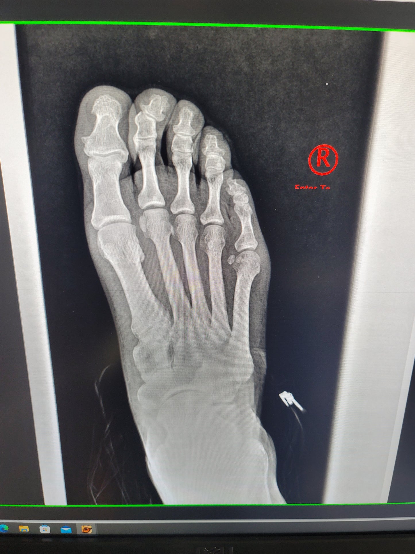 digital podiatry x-ray machine