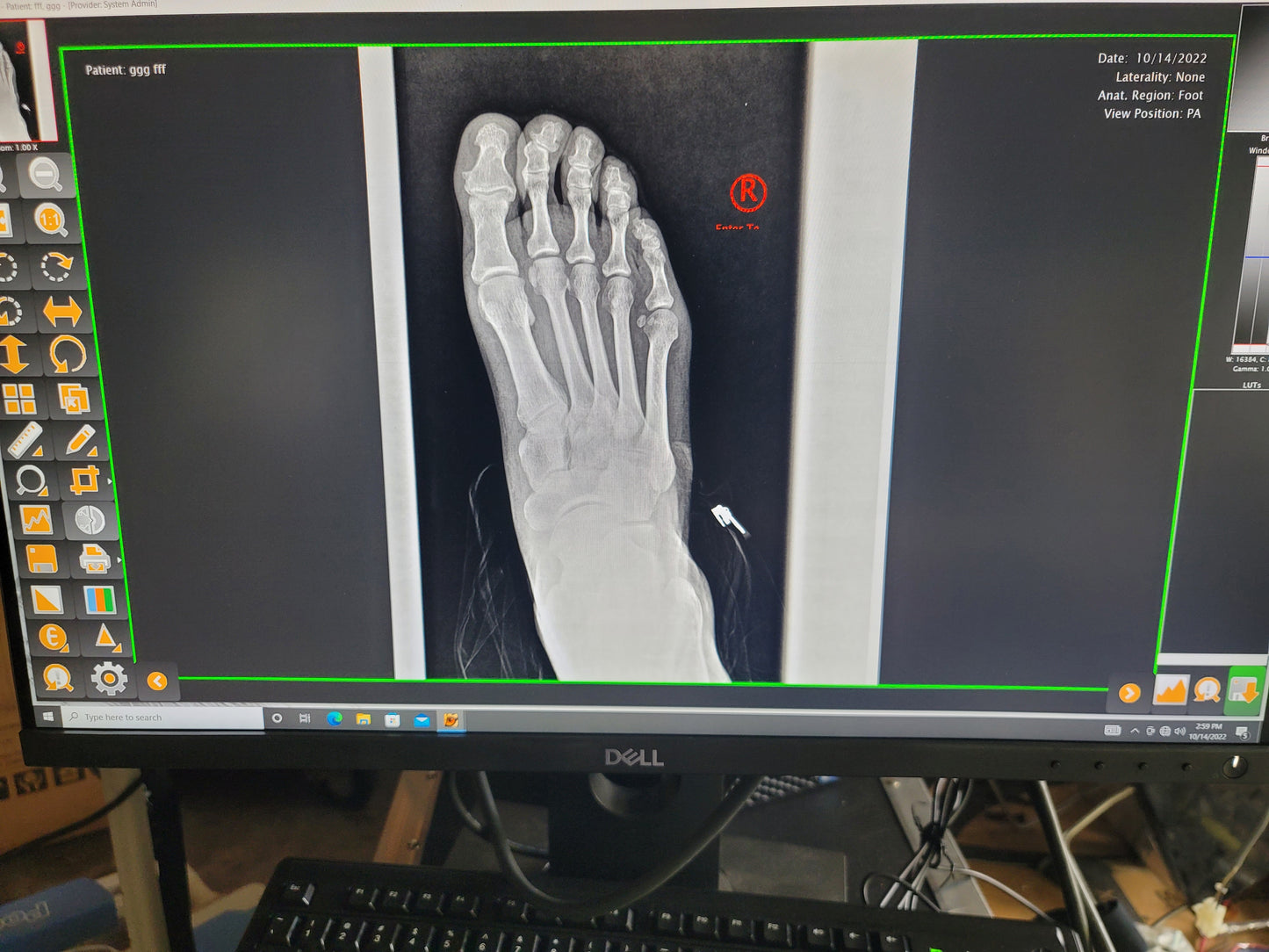 digital podiatry x-ray machine