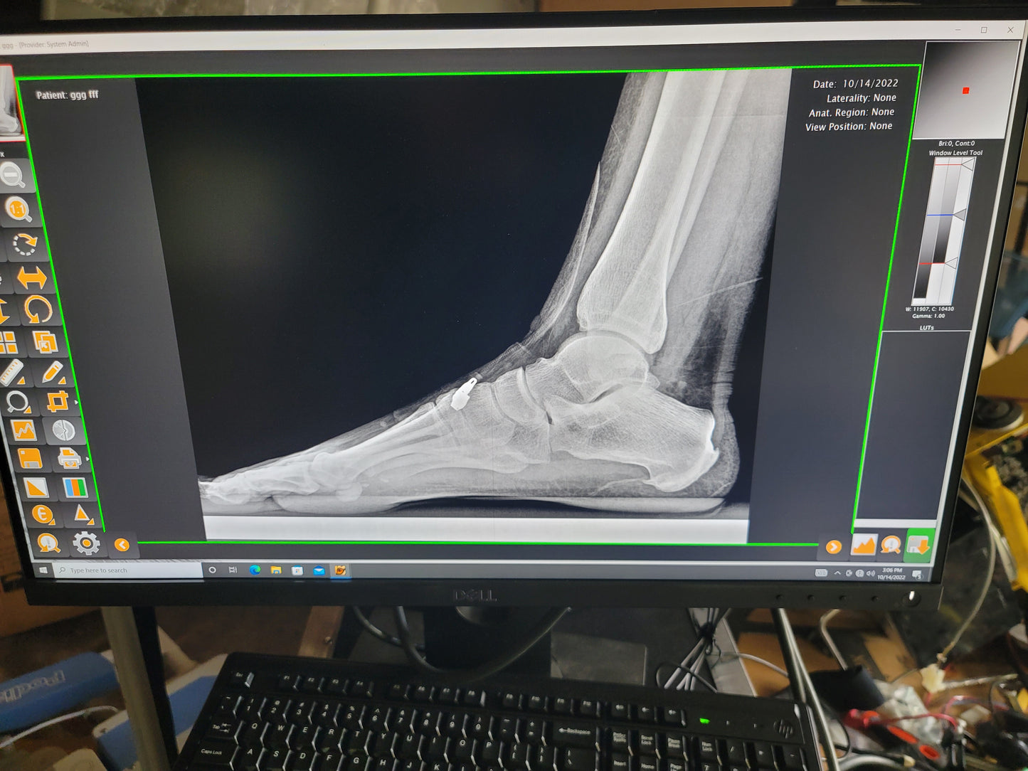podiatry x-ray digital