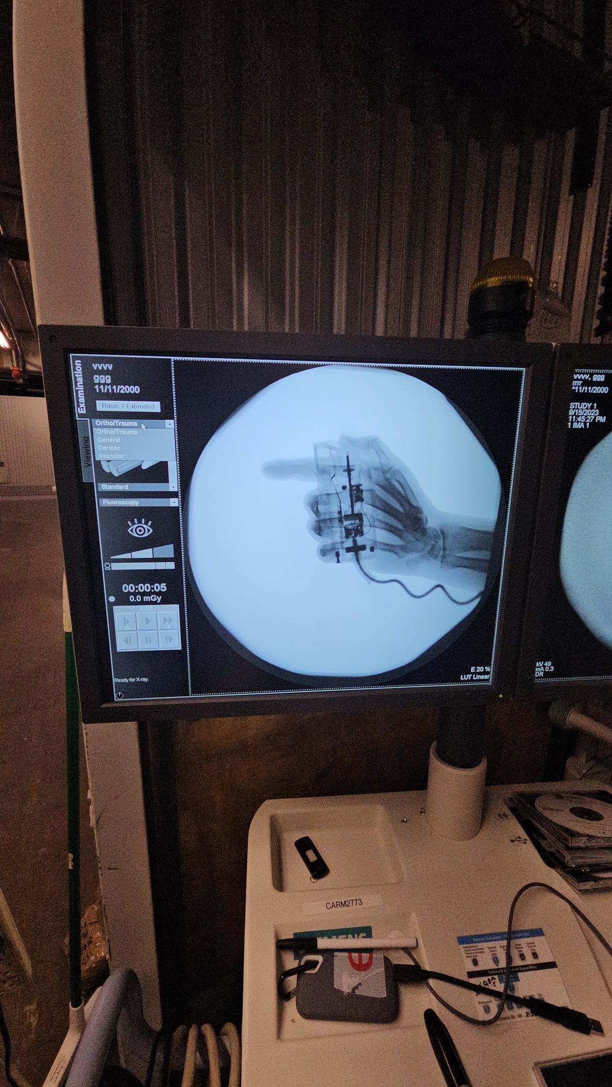 siemens arcadis advantic c-arm
