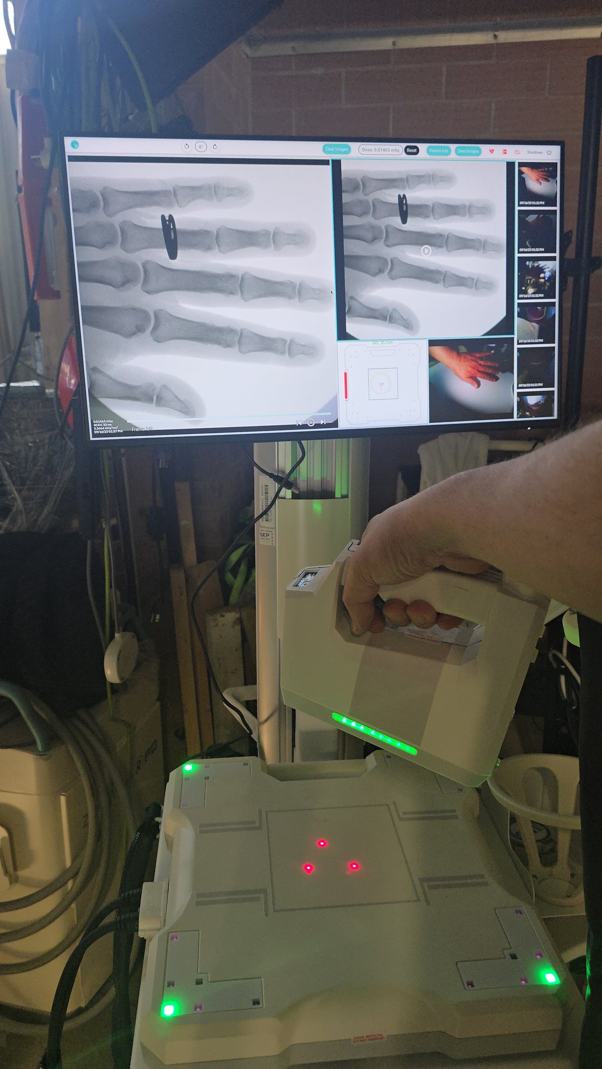 MINI C-ARM fluoroscopy