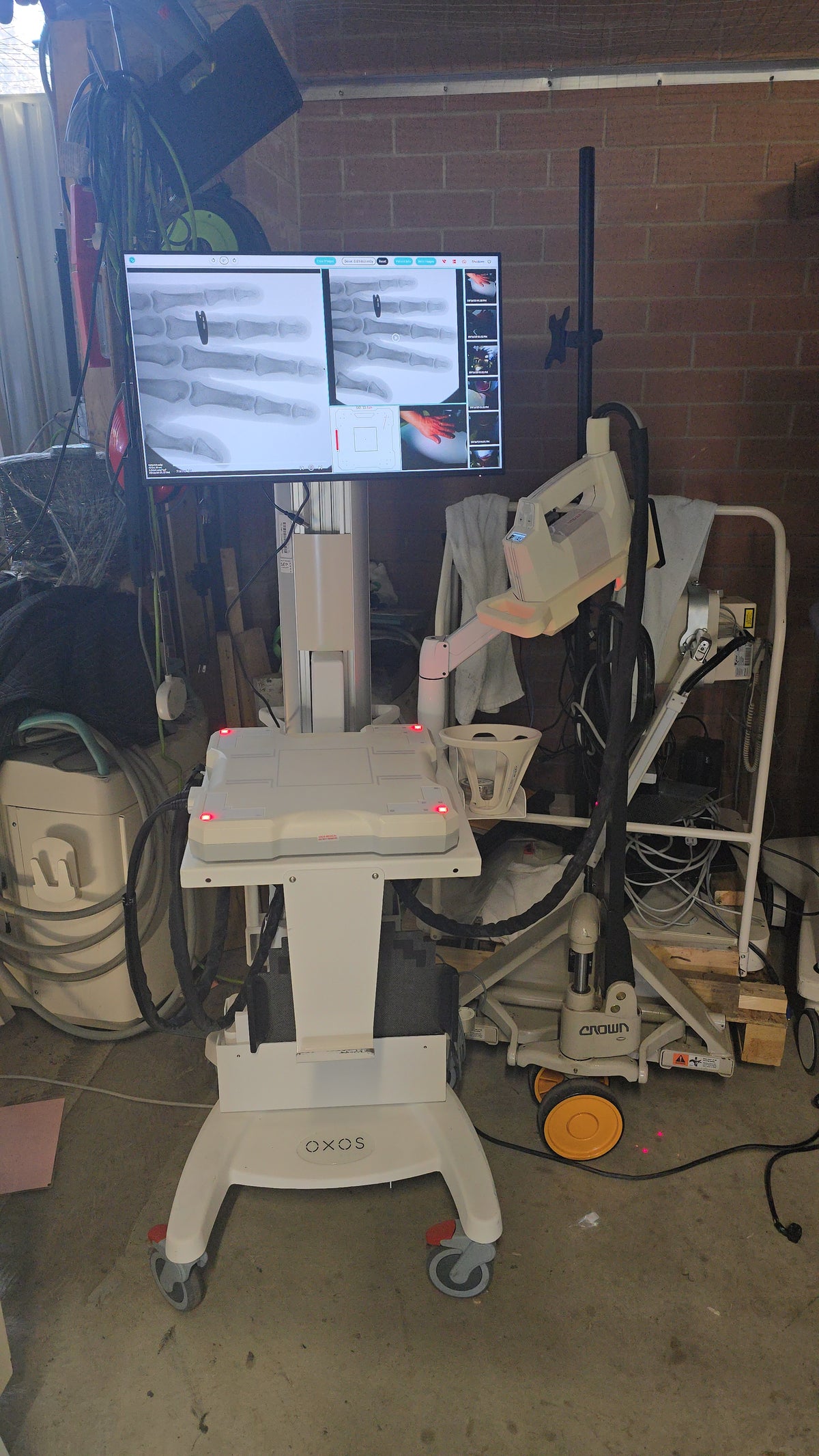MINI C-ARM fluoroscopy