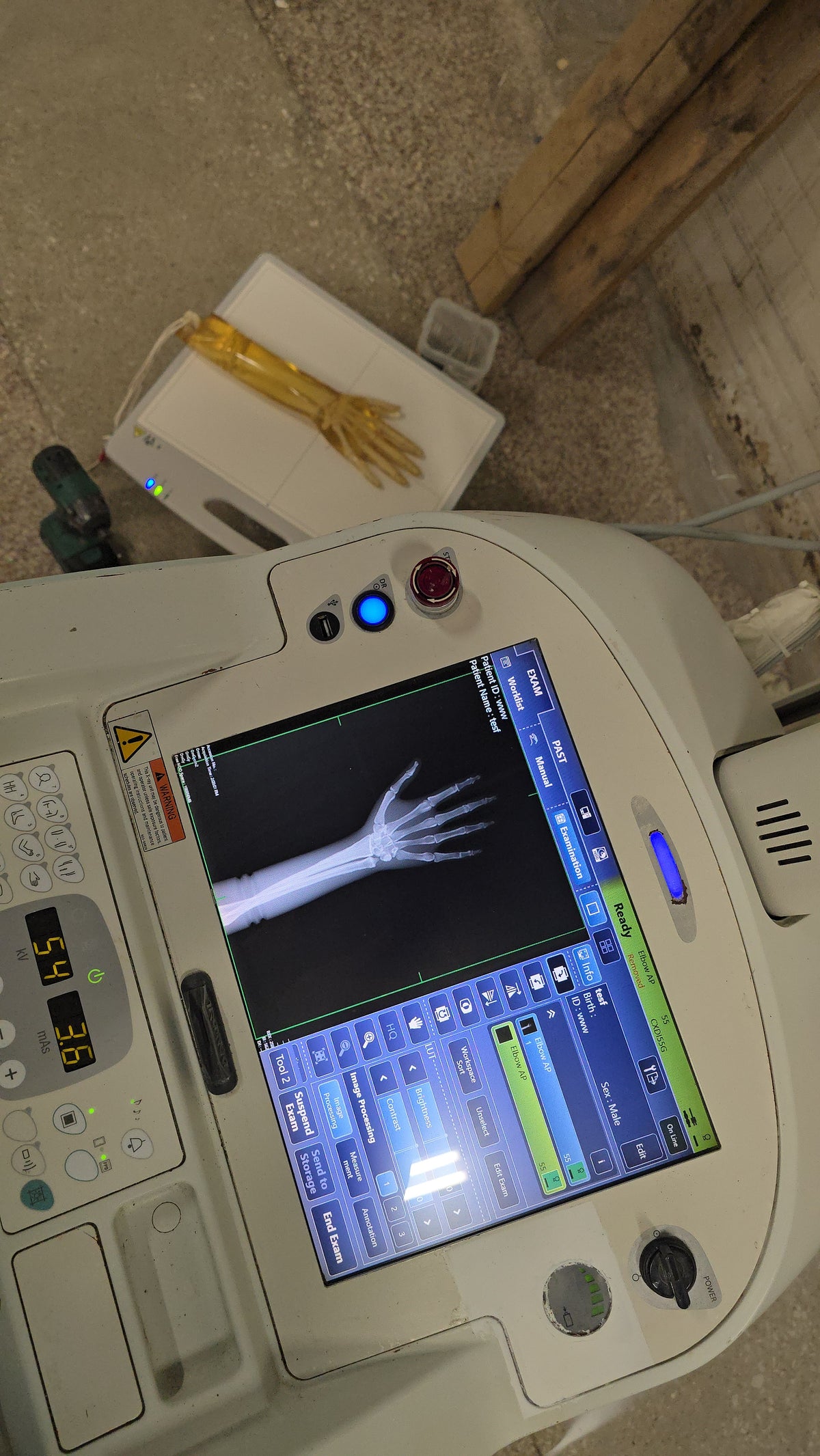 digital mobile x-ray machine mobile art MX7