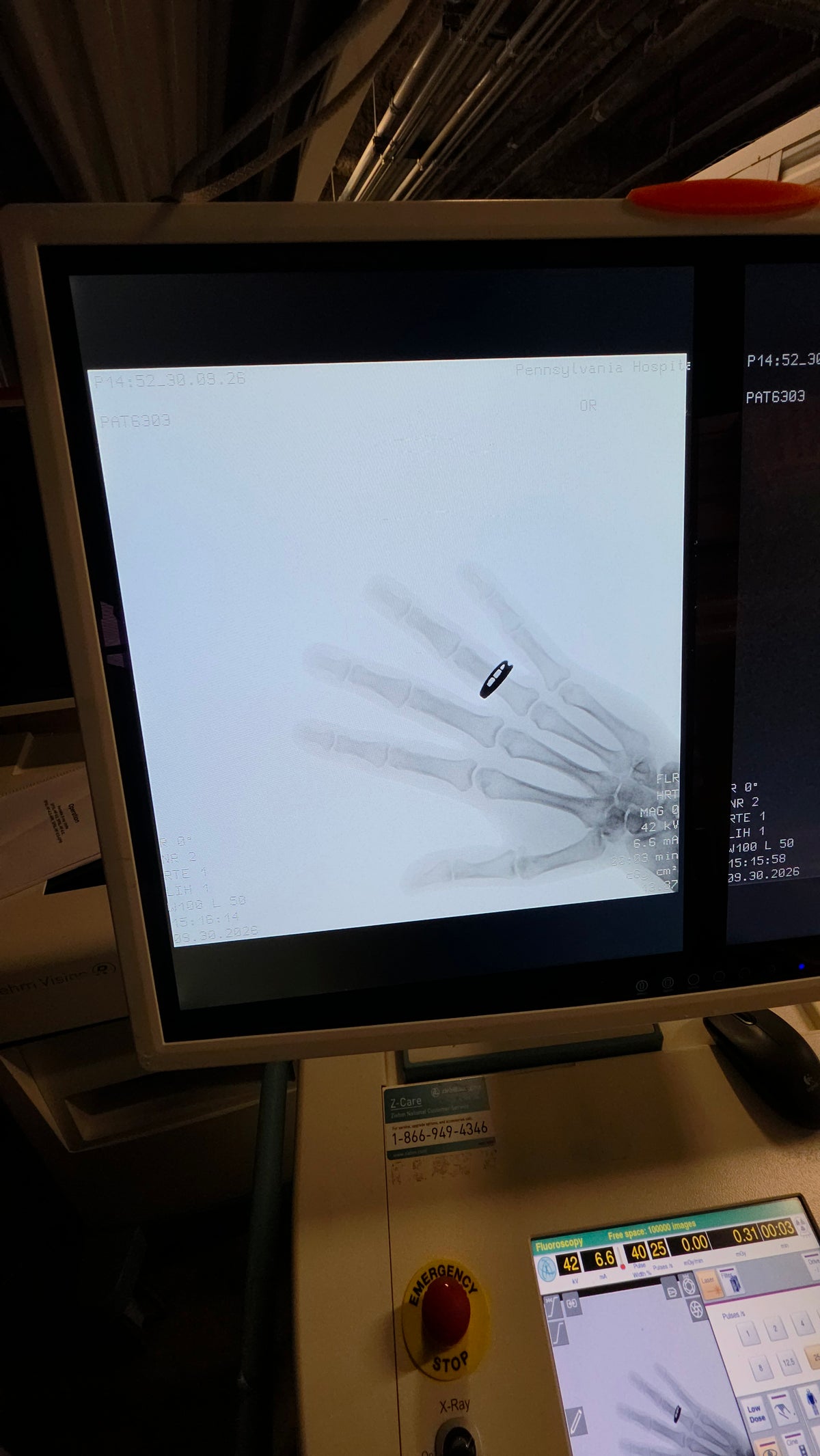ziehm vision RFD 3D c-arm