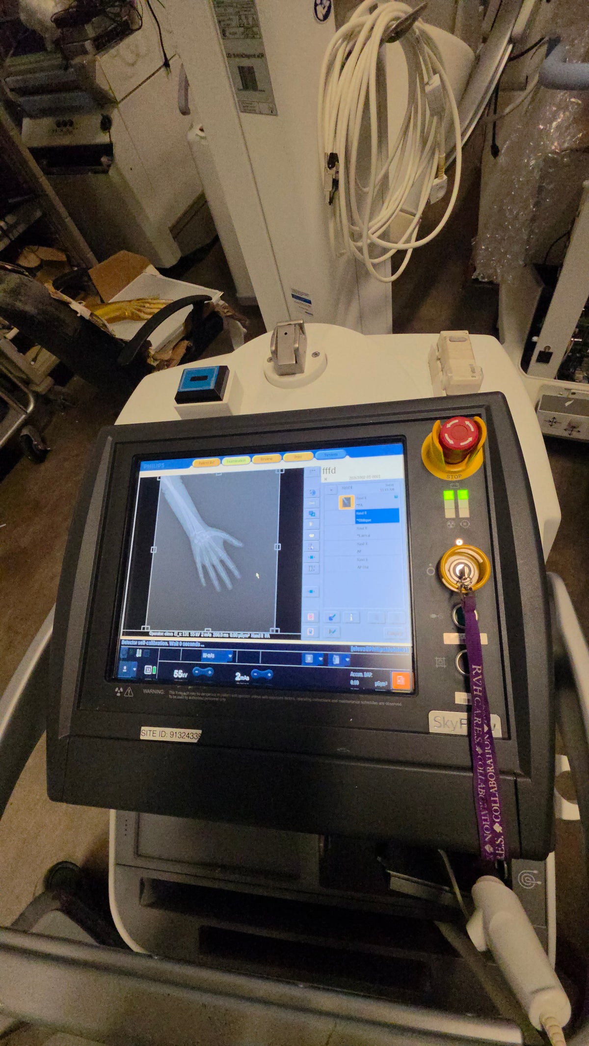 Philips Mobile Diagnost with DR Mobile Xray machine