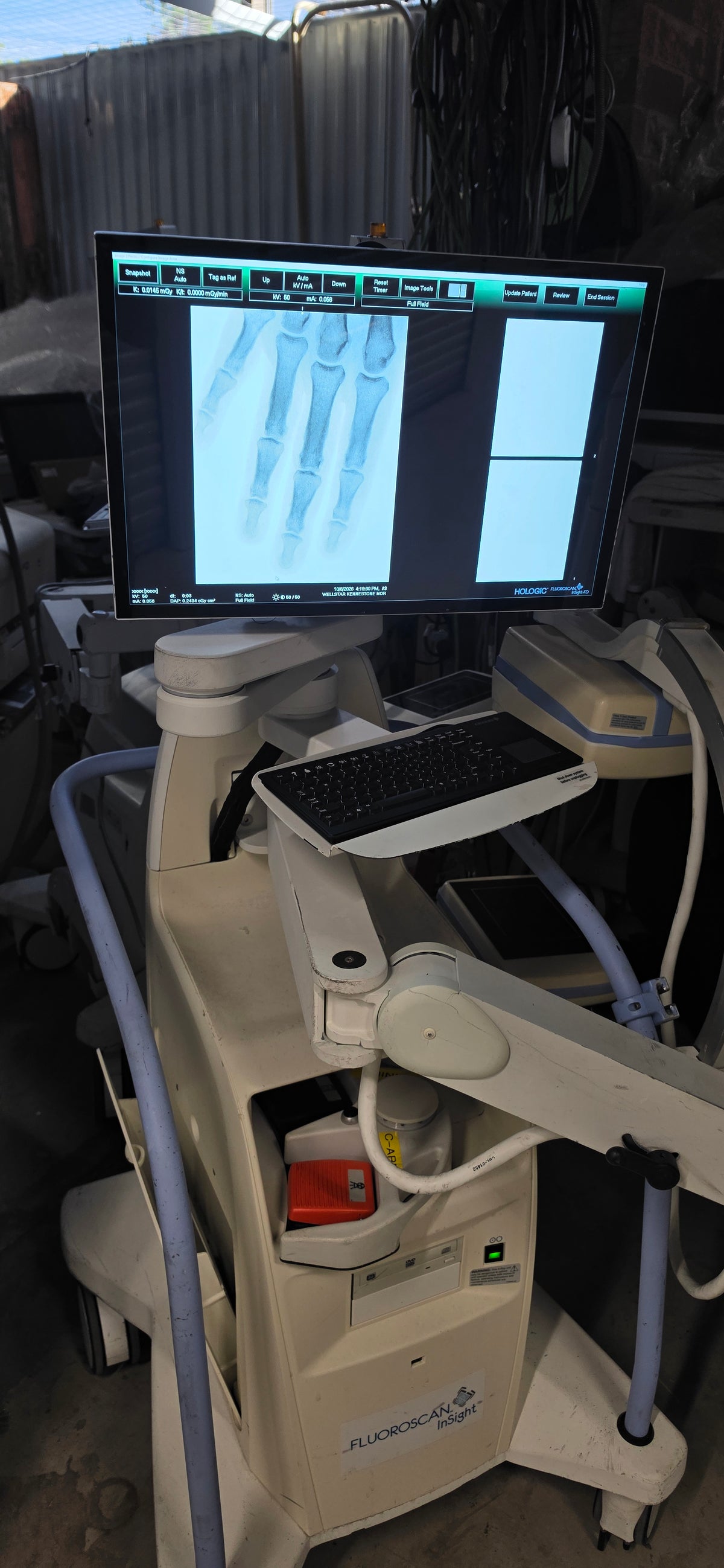 hologic insight 2 FD mini c-arm windows 10