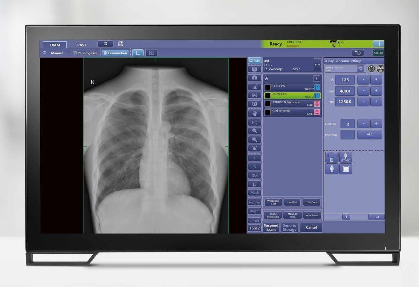 digital portable x-ray machine wireless Canon