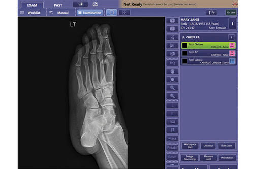 digital portable x-ray machine wireless Canon