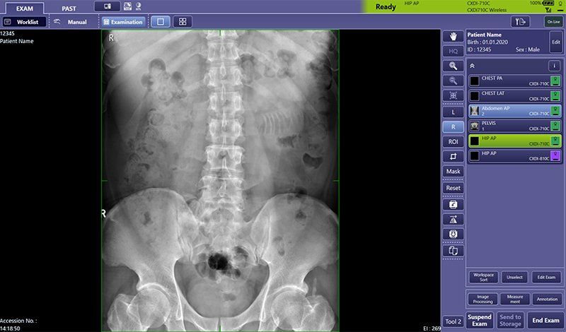 SHIMADZU MobileDart Evolution DR