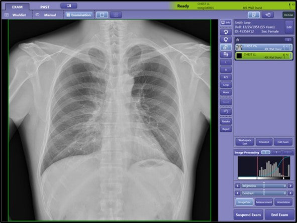 digital x-ray machine 4KW Canon radpro