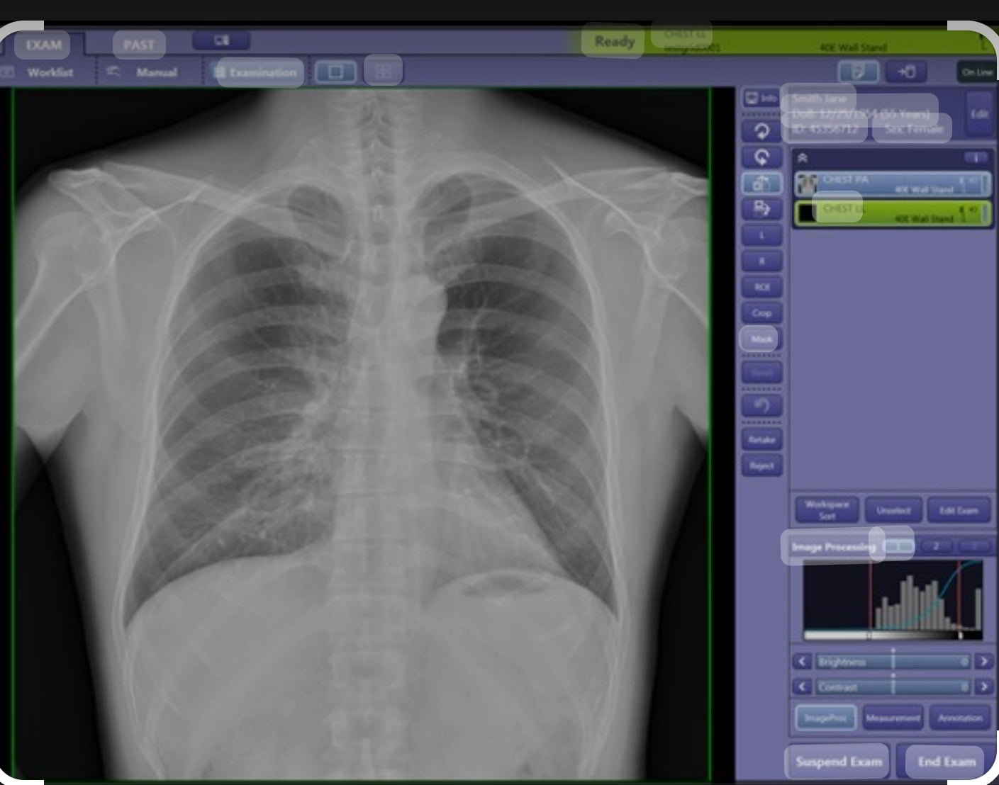 digital xray mobile wireless DR panel shimatzu