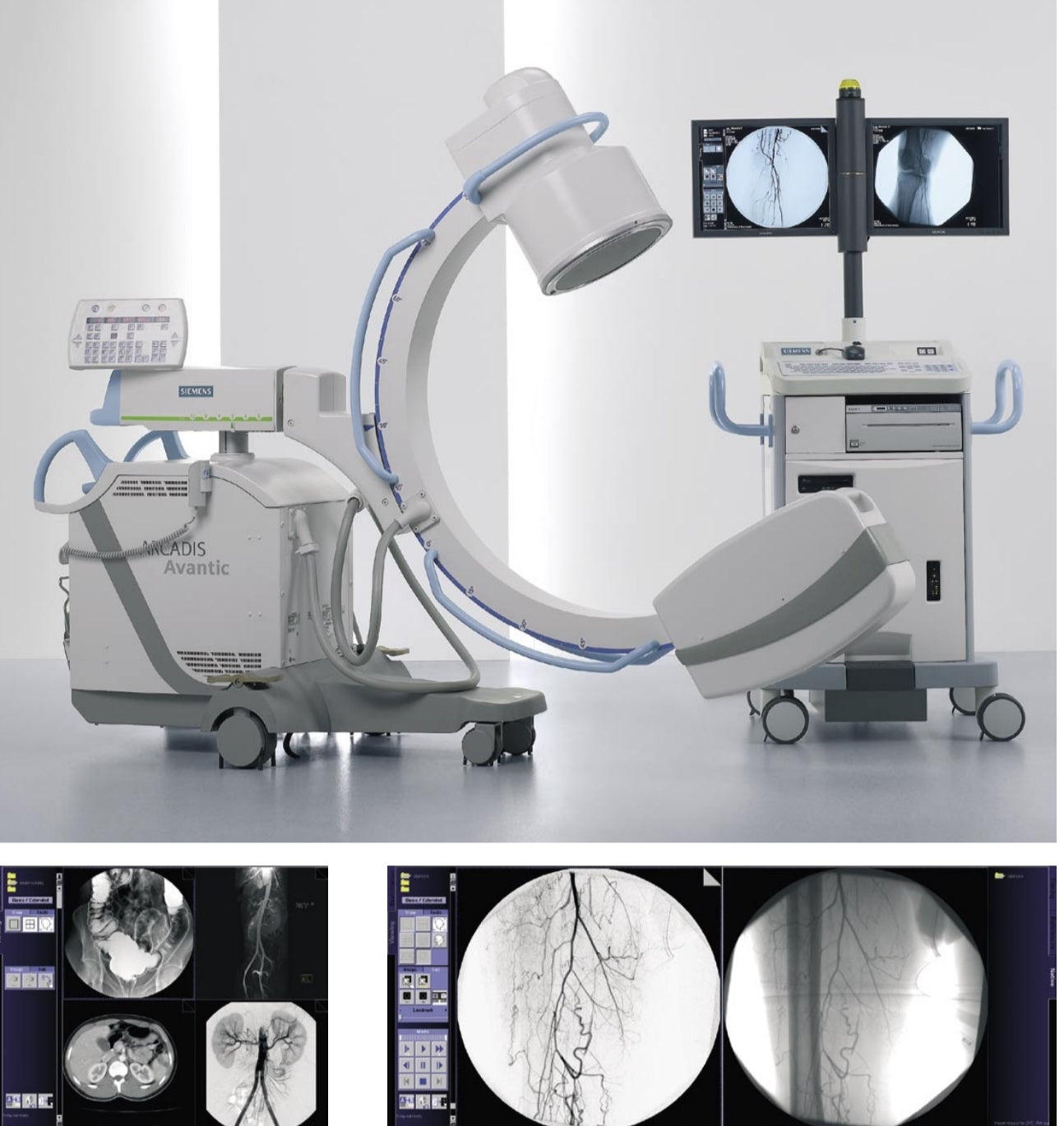 c-arm siemens arcadis advantic