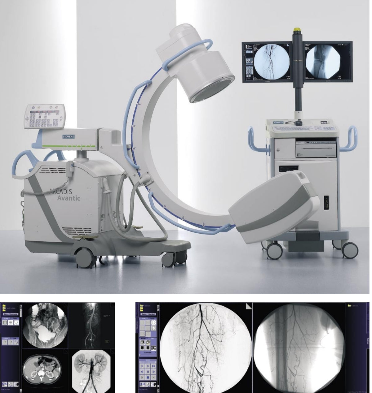 siemens arcadis advantic c-arm