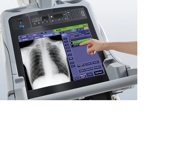 digital xray mobile wireless DR panel shimatzu