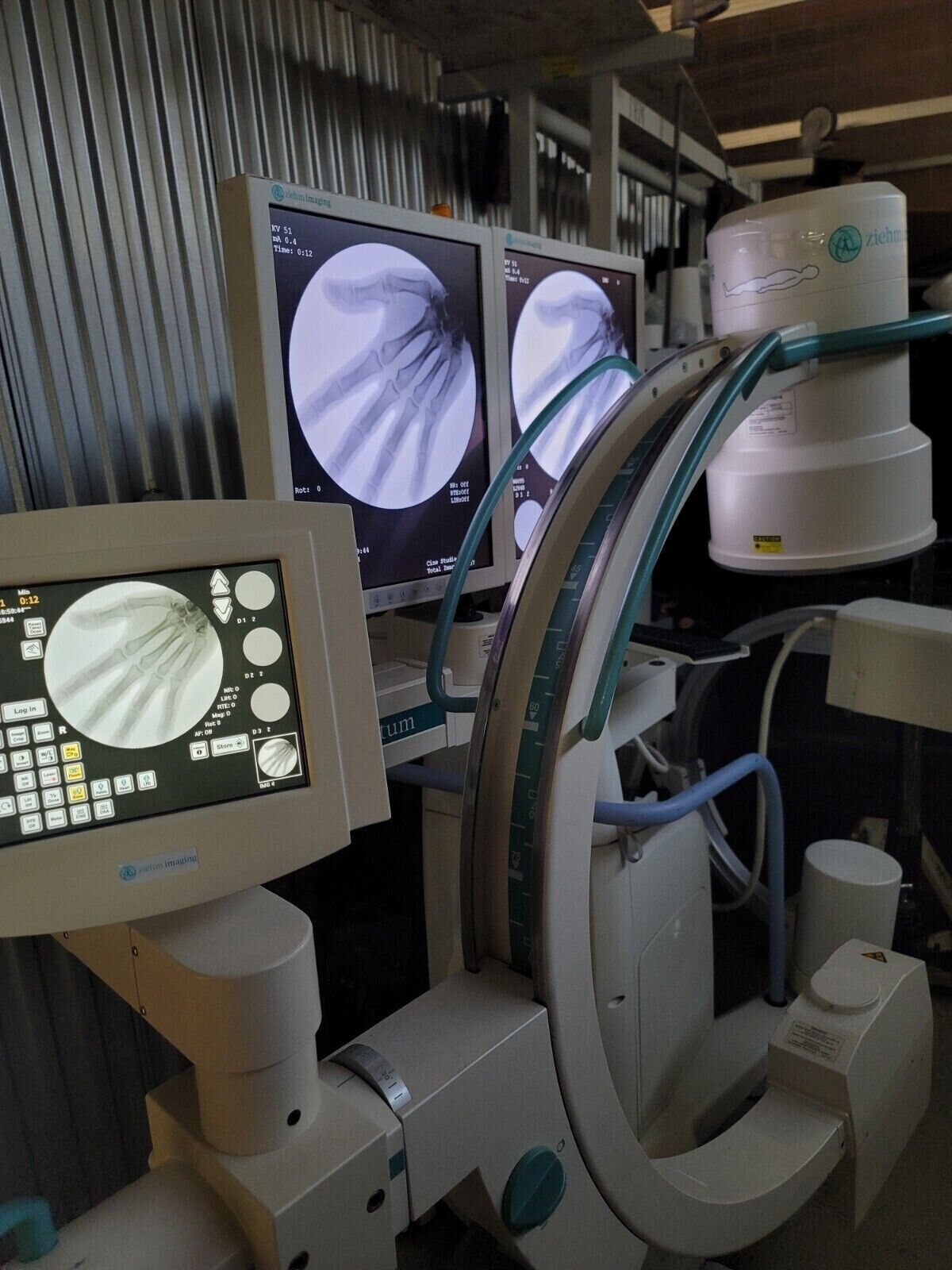 ziehm quantum mobile c-arm