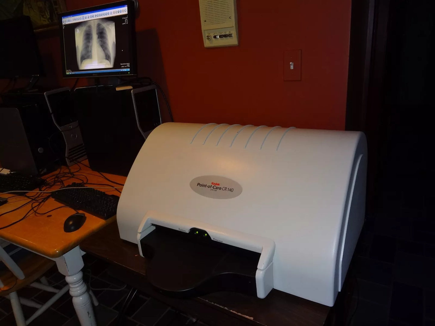 digital x-ray scanner carestream