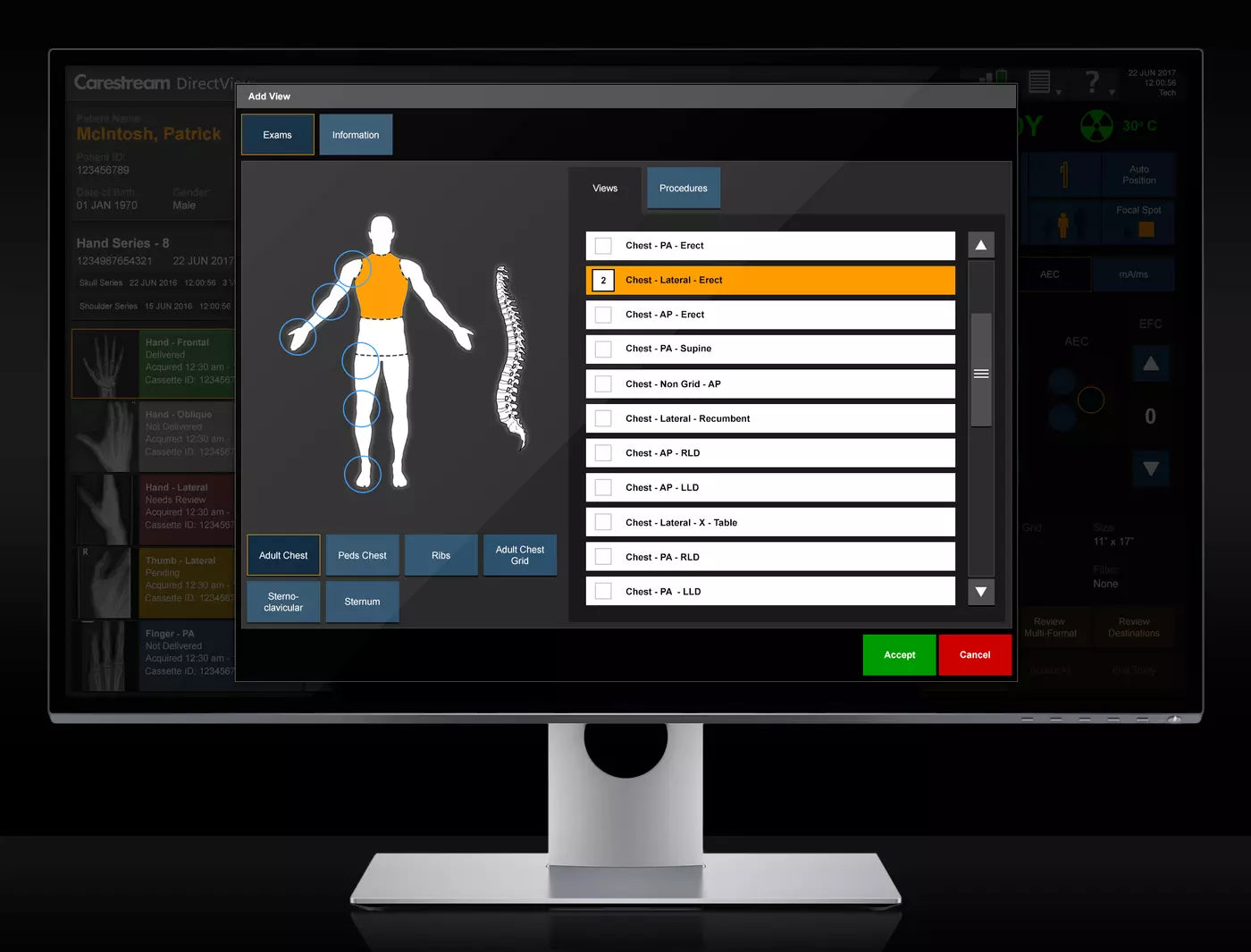 digital x-ray scanner carestream