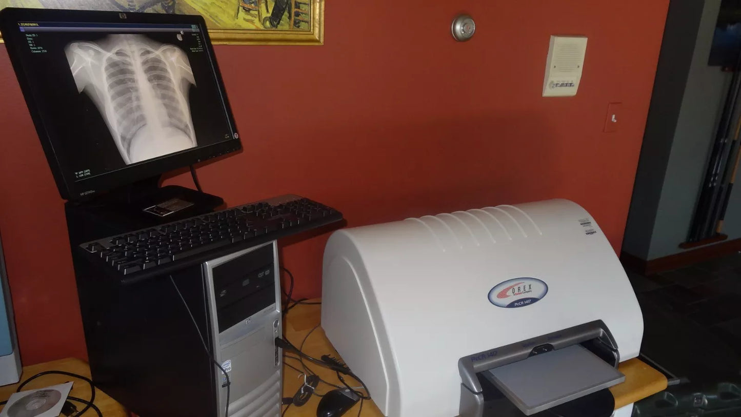 digital x-ray scanner carestream