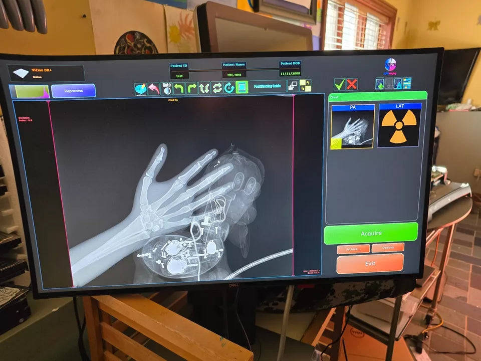 Dr Panel wireless DR panel vsion konica minolta x-ray flat panel – digital x-ray ...