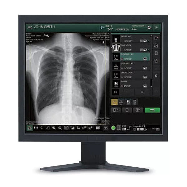 Fcr Digital digital mammography reader fuji FCR XL-2 – digital x-ray machines