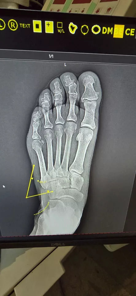 wireless DR panel x-ray