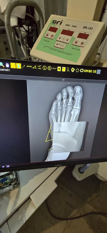 wireless DR panel x-ray