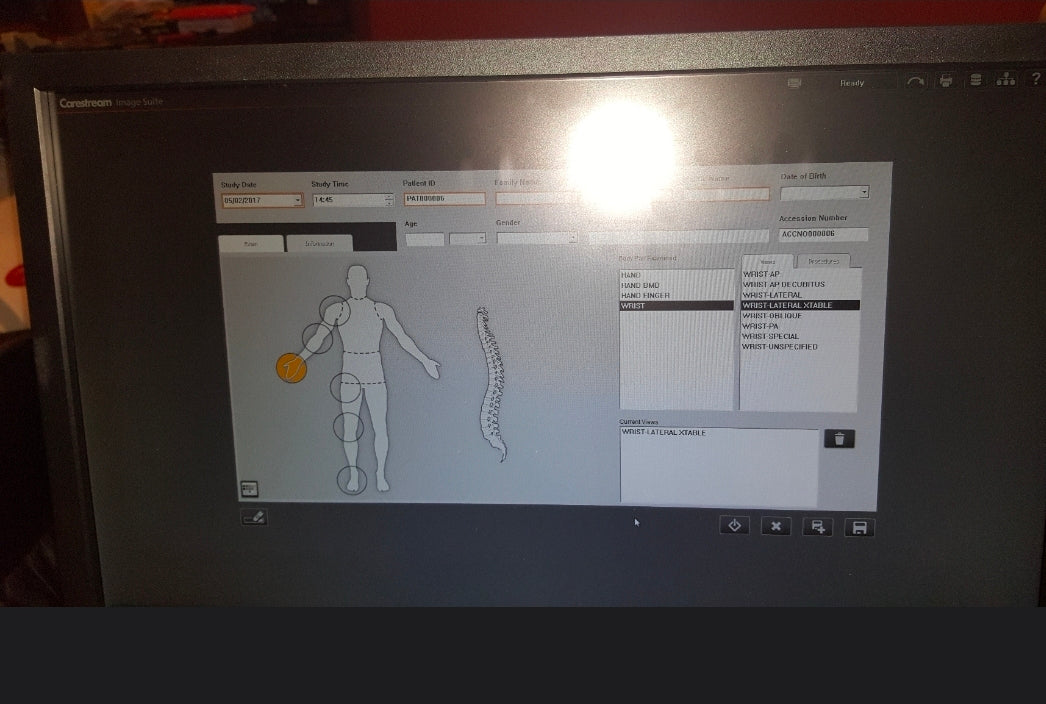 digital xray scanner reader carestream vita cr