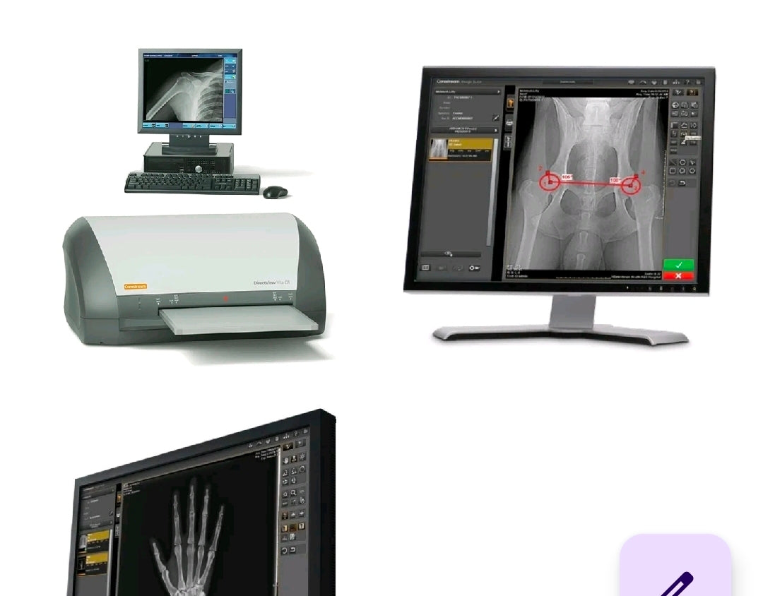 digital xray scanner reader carestream vita cr