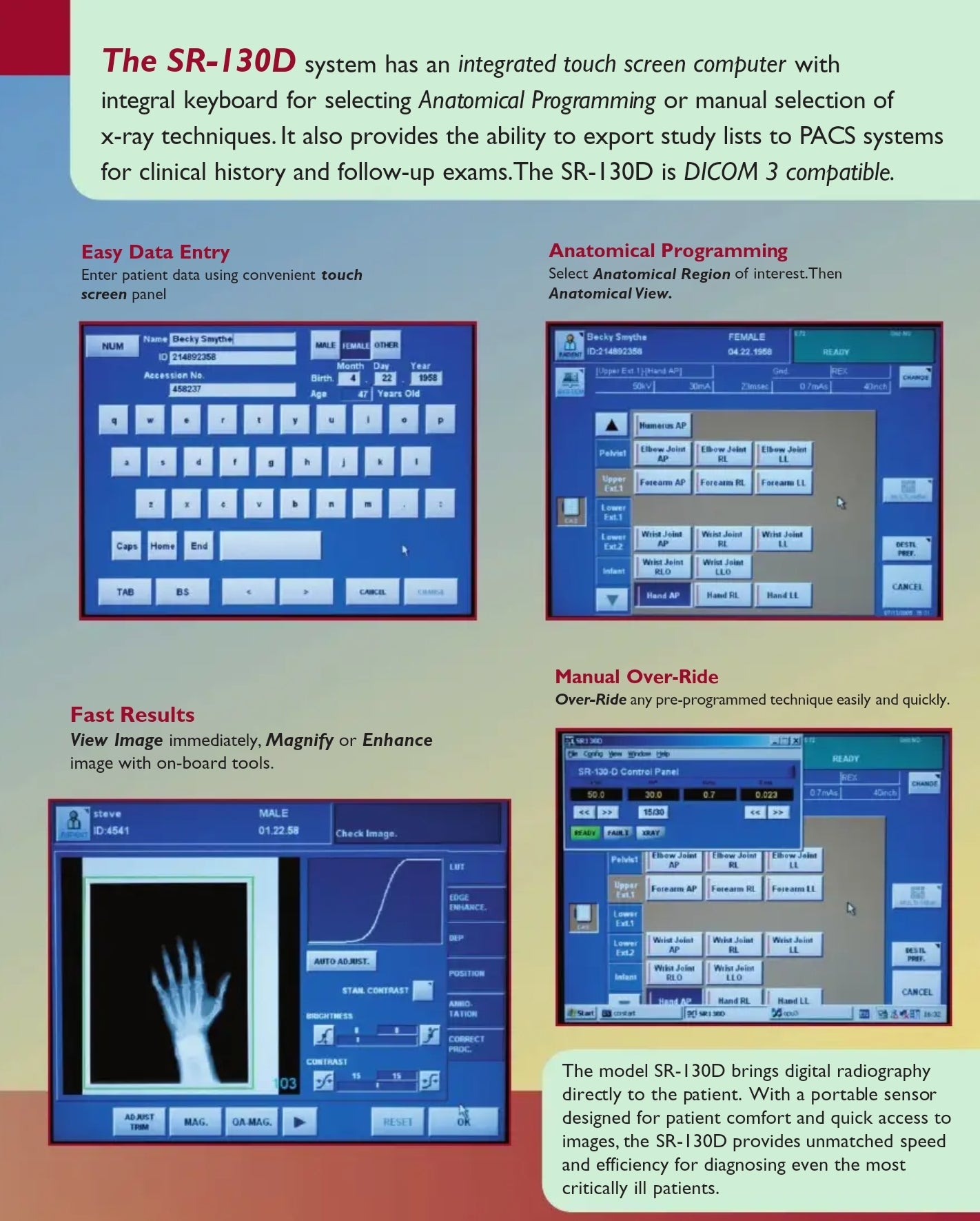 SR-130D source ray digital portable xray